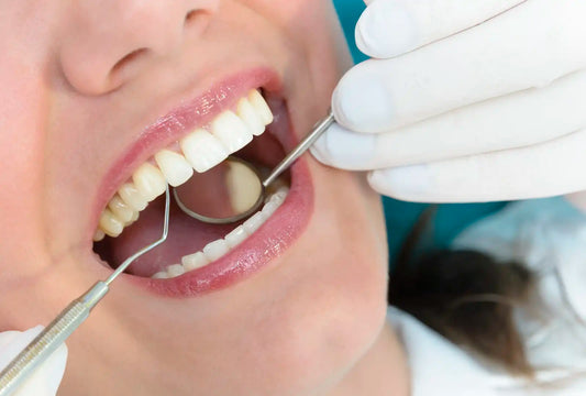 The Five Stages of Tooth Decay – How to Prevent and Treat Each Stage