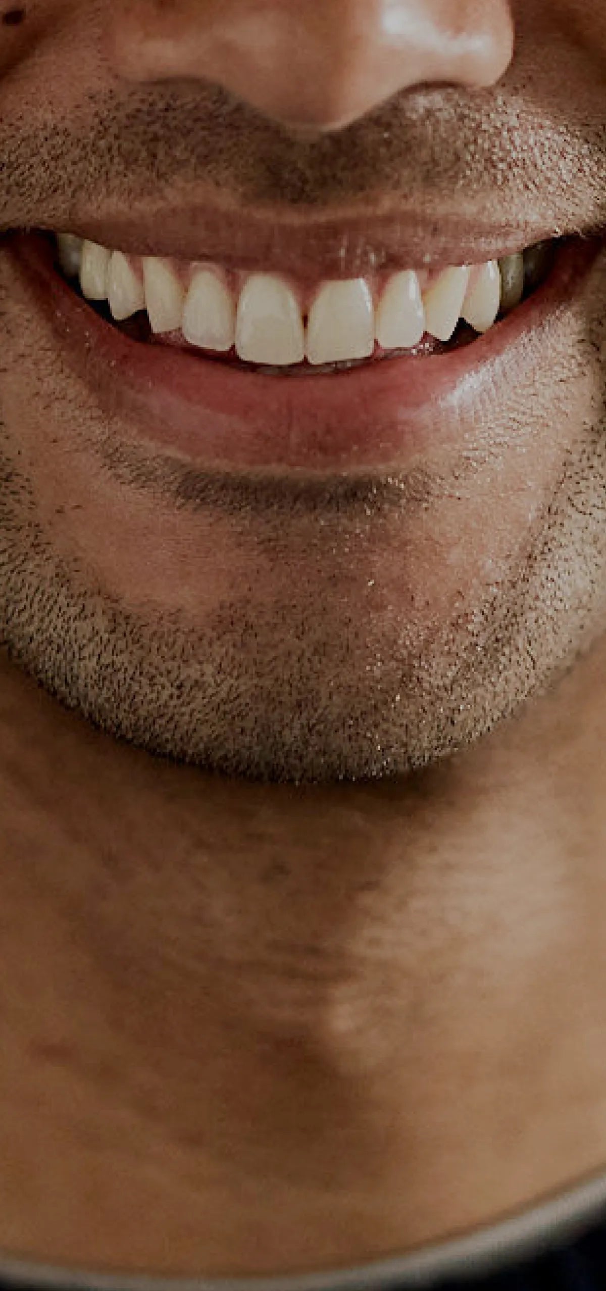 Photo of a man smiling with a close of up of his teeth